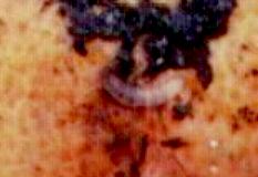 Ectomyelois ceratoniae